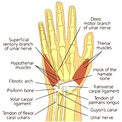 Sindrome Del Canale Di Guyon Fisiatria Interventistica