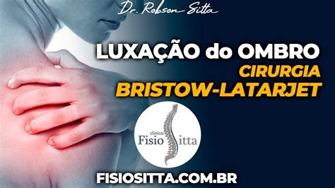 LuxaÇÃo Ombro Cirurgia Bristow Latarjet Instabilidade Anterior Clínica