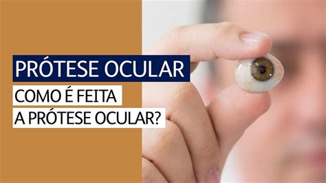 Como é feita a prótese ocular YouTube