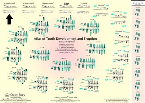 A Poster With Different Types Of Toothbrushes And Their Corresponding