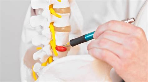 Discectomy Vs Laminectomy - What’s the Difference?