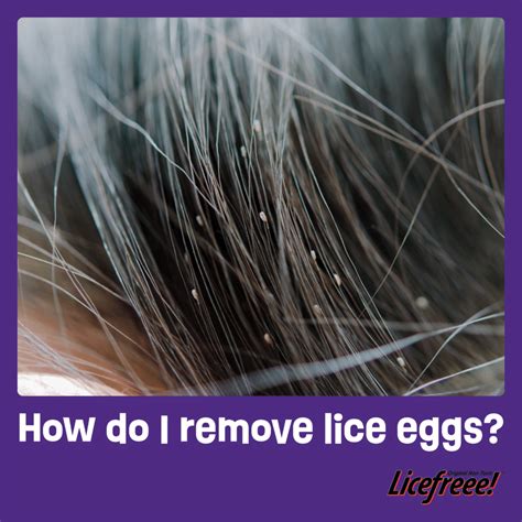 How Do I Remove Lice Eggs Licefreee