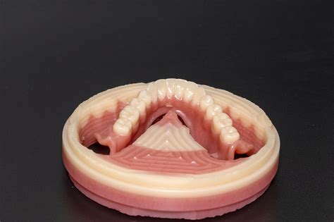 Ivotion Milled Dentures Utica Dental Laboratory