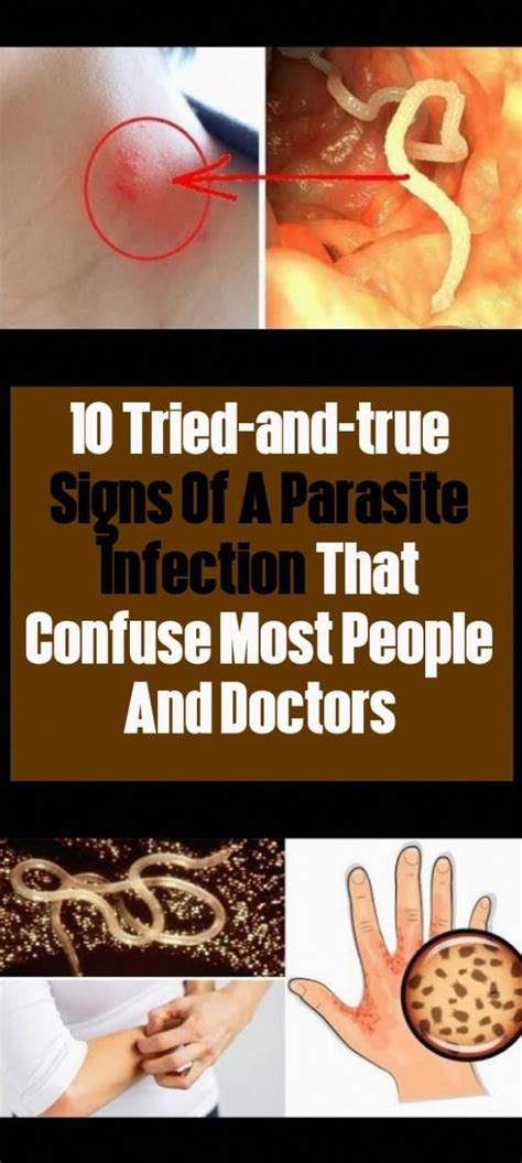 Human Parasites What Are They And Symptoms And Signs To Recognize Parasites Humanparasites