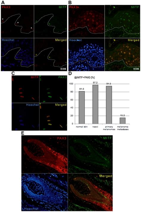 Ac Double Immunofluorescent Staining Showing Co Expression Of Pax