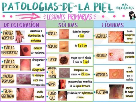 Lesiones cutáneas La Escuelita Médica Med school study Medicine