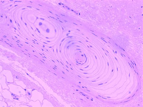 Pacinian Corpuscle