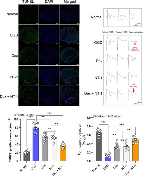 Combination Of Dexmedetomidine And Netrin 1 Reduced The Neuronal