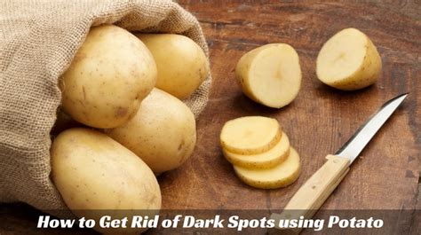 How To Get Rid Of Dark Spots Using Potato