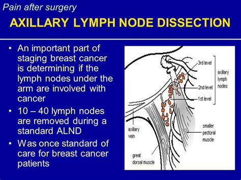 Swollen Lymph Nodes Rheumatoid Arthritis Are Your Swollen Glands A