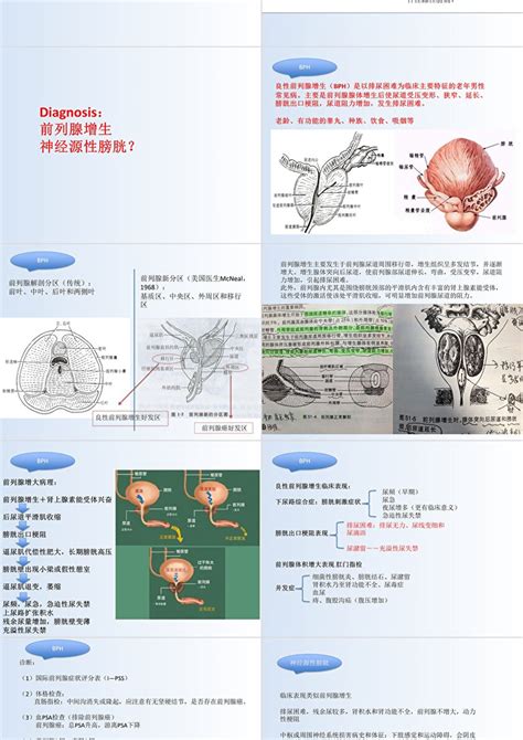 泌尿外科前列腺增生病例讨论ppt模板卡卡办公