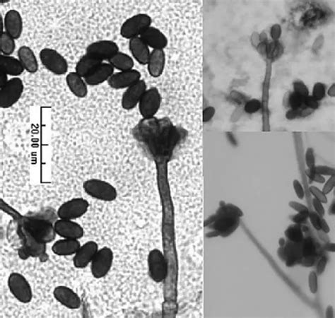 Understanding How Mold Grows And How To Prevent Mold Growth