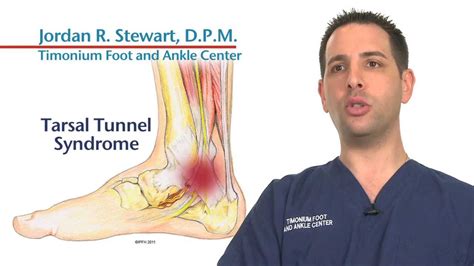 Tarsal Tunnel YouTube