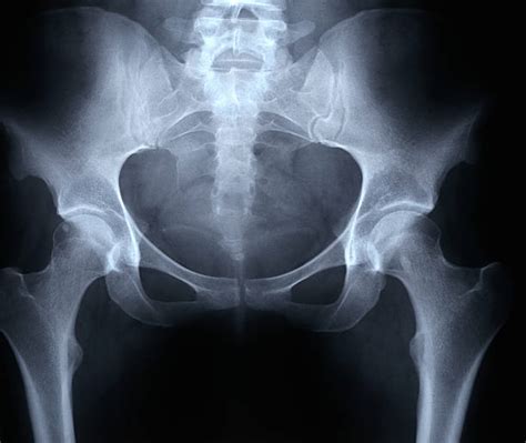 Arriba 98 Foto Cual Es El Pelvis De La Mujer El último