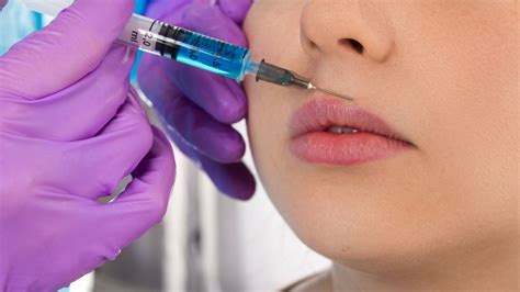 Botox Labial Como A Toxina Botulínica Age Na Boca Clínica Dra