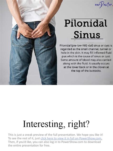 Pilonidal Sinus.9240337.Powerpoint | PDF