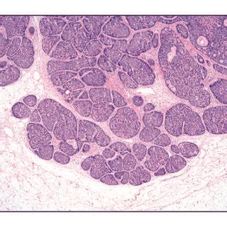 Histopathologic Findings A Low Magnification Of Skin Surface Showing