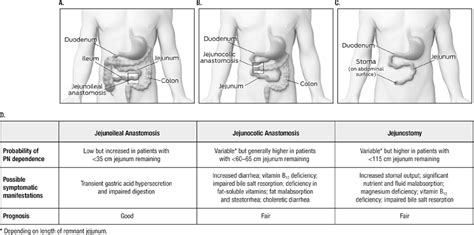 Pathophysiology Of Short Bowel Syndrome Tappenden 2014 Journal Of