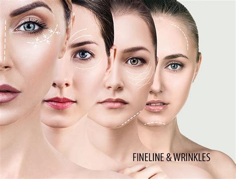 Fine Line Wrinkles