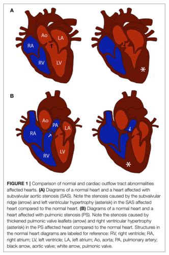 Cardio Flashcards Quizlet