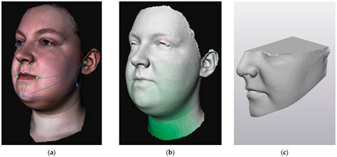 Jcm Free Full Text Reliability Of 3d Stereophotogrammetry For Measuring Postoperative Facial