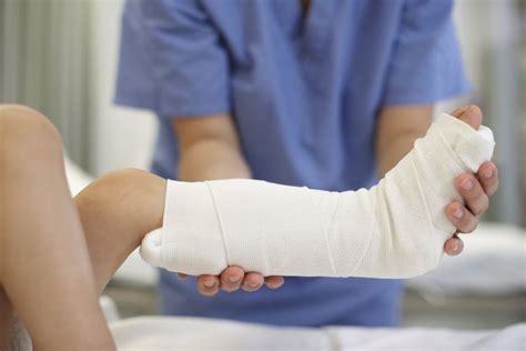 Treatment of Broken Bones – Fracture Care Options