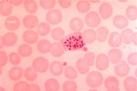 Free Picture Plasmodium Vivax Immature Schizont Blood Smear Parasite