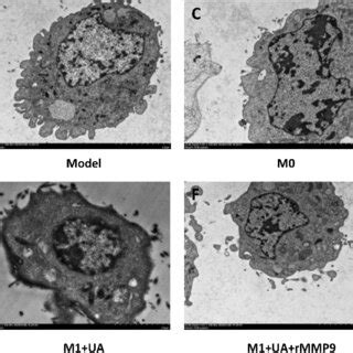 Transmission electron microscopy images of SH-SY5Y cells. Notes: (A ...