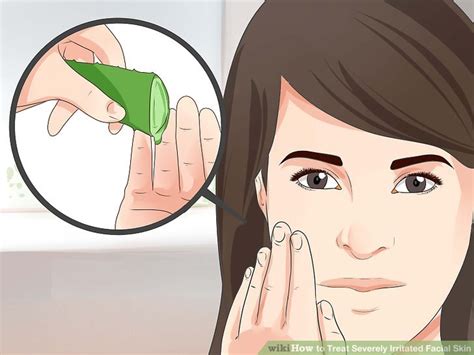 4 Ways To Treat Severely Irritated Facial Skin Wikihow