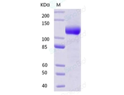 Sino Biological Human Neuropilin Nrp Protein Ecd Fc Tag Mg