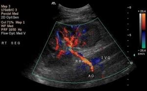 Renal Duplex Ultrasound - LICC