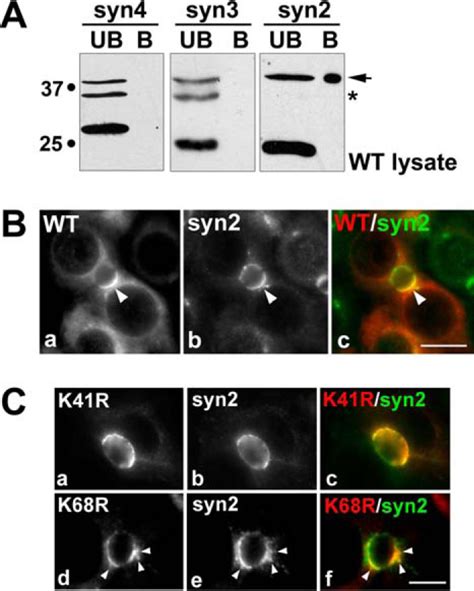 The Gtp Bound And Sumoylated Form Of The Rab Small Molecular Weight