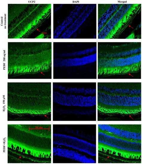 Pedf Protects Human Retinal Pigment Epithelial Cells Against Oxidative