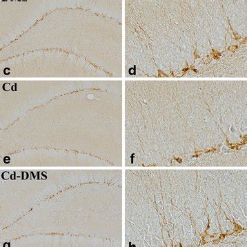 Immunohistochemistry For Dcx In The Dentate Gyrus Of Treated Rats