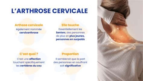 Arthrose cervicale Symptômes Causes Traitements douleurs cou