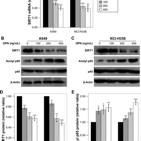 Opn Inhibits Sirt1 Expression And Promotes Acetylation Of Nf κb P65