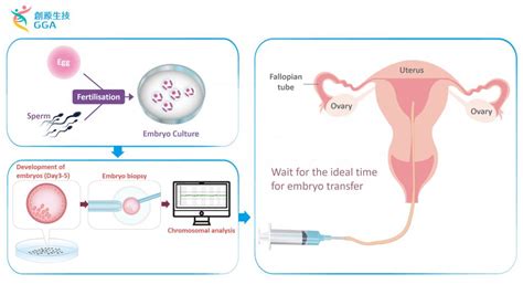 pgt  preimplantation genetic testing  aneuploidies gga malaysia