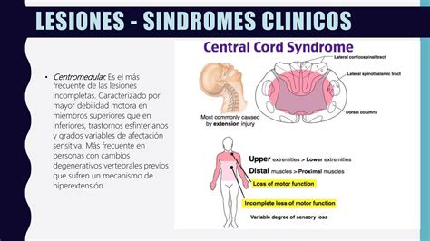 Trauma Raquimedular Ppt