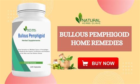 Treatment of Bullous Pemphigoid with These Best Herbal Elements