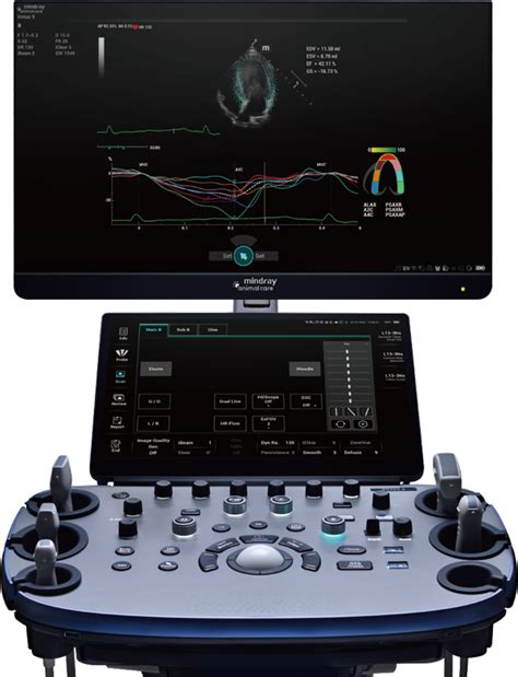 Mindray Vetus 9 Ultrasound System Northern Diagnostics