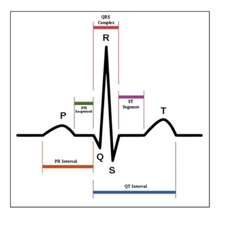 EKG Exam 1 Flashcards Quizlet