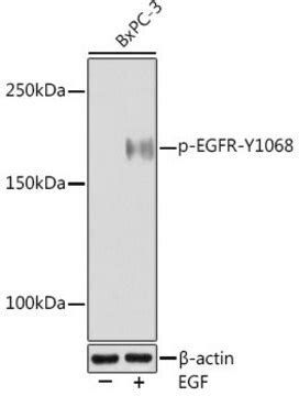 Anti Phospho EGFR Y992 Antibody Produced In Rabbit Sigma Aldrich