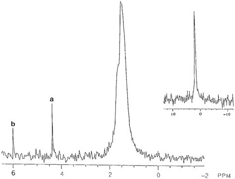 31 P Nmr Spectrum Acquired After Reaction Between Crv 20 Mm And