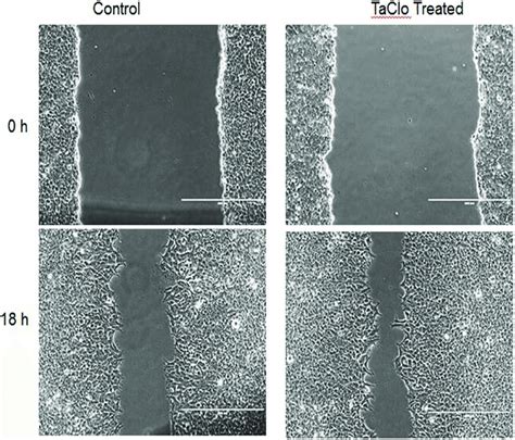 Analysis Of Cell Migration By In Vitro Scratch Assay Images Were