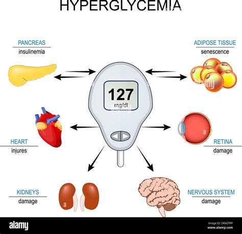 hiperglucemia Resistencia a la insulina Relación entre las células de