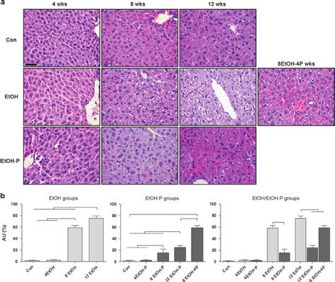 Representative Photomicrographs Of Liver Sections Stained With