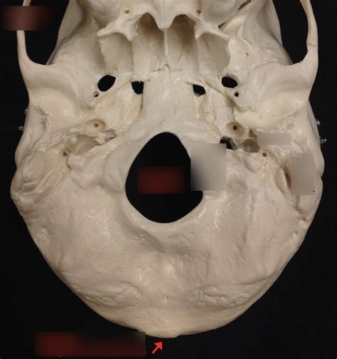 Underside Of Skull A P Practical 2 Study Guide Diagram Quizlet