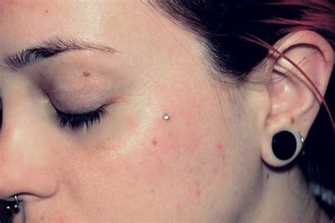 Micro Dermal Piercing Ideas Faqs Ultimate Guide Part