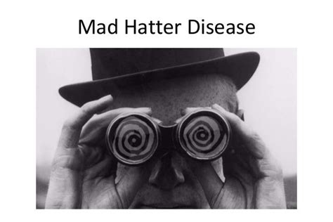 Mad hatter disease