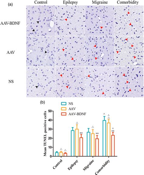 BDNF Overexpression Reduces Neuronal Cell Loss A The Number Of